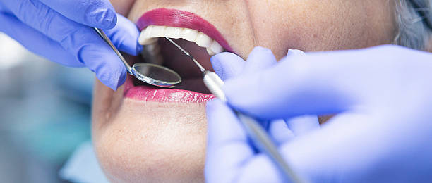 Best Emergency Dental Care for Broken or Chipped Teeth in Pen Mar, PA